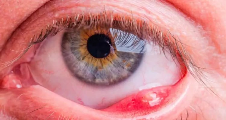 Consulta de oftalmologia preventiva para detecção precoce de doenças oculares na Clínica Pro Vida em Betim